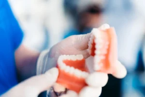 Pros And Cons Of Partial Dentures You Should Know