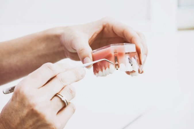 Dental Implants inner