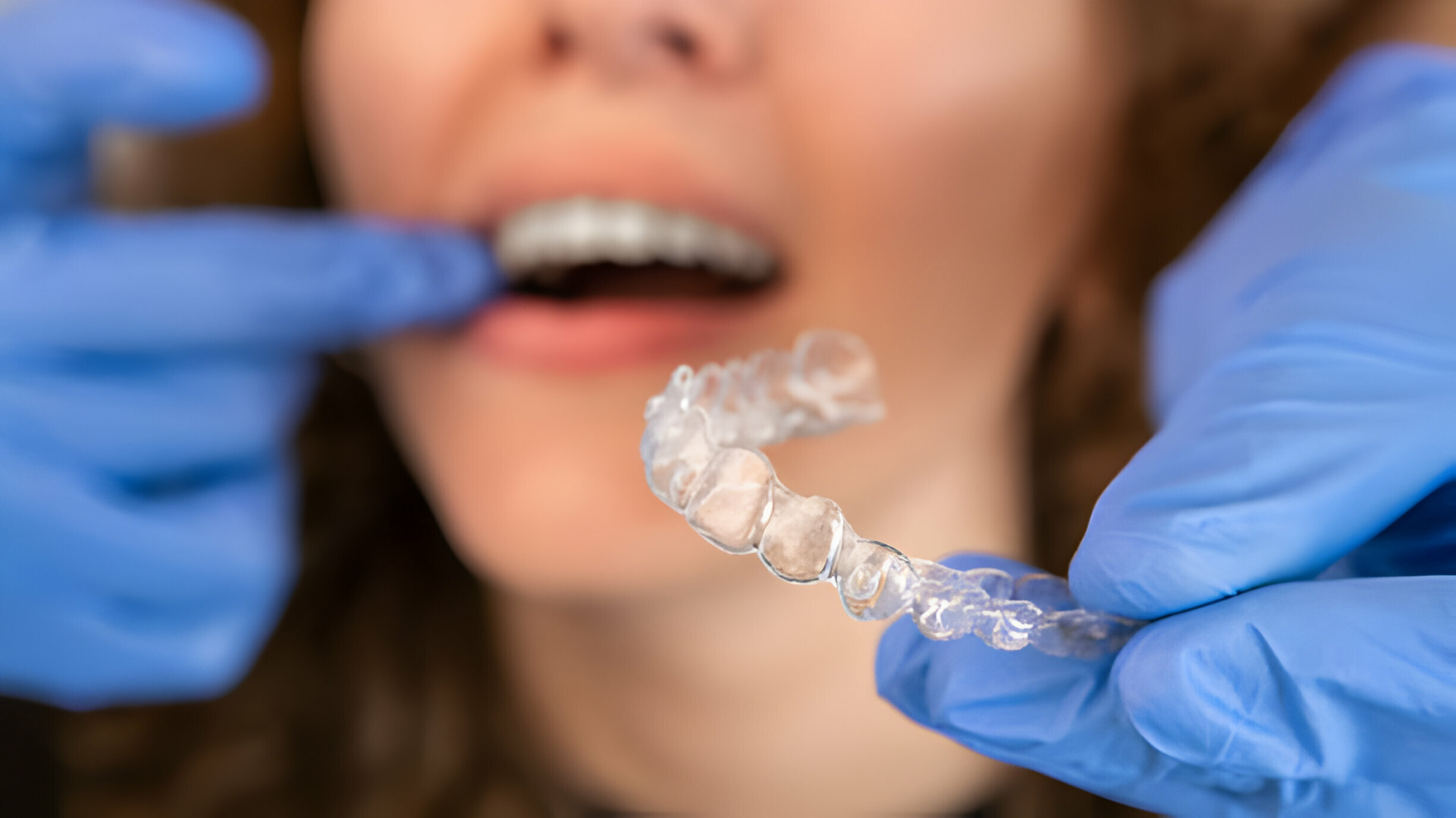 Is Invisalign Right for You? Learn More and Find a Consultation in Irving, Texas_2
