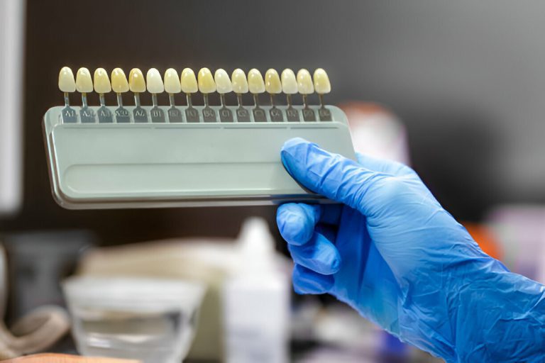 How Porcelain Veneers Can Fix Your Dental Imperfections_FI
