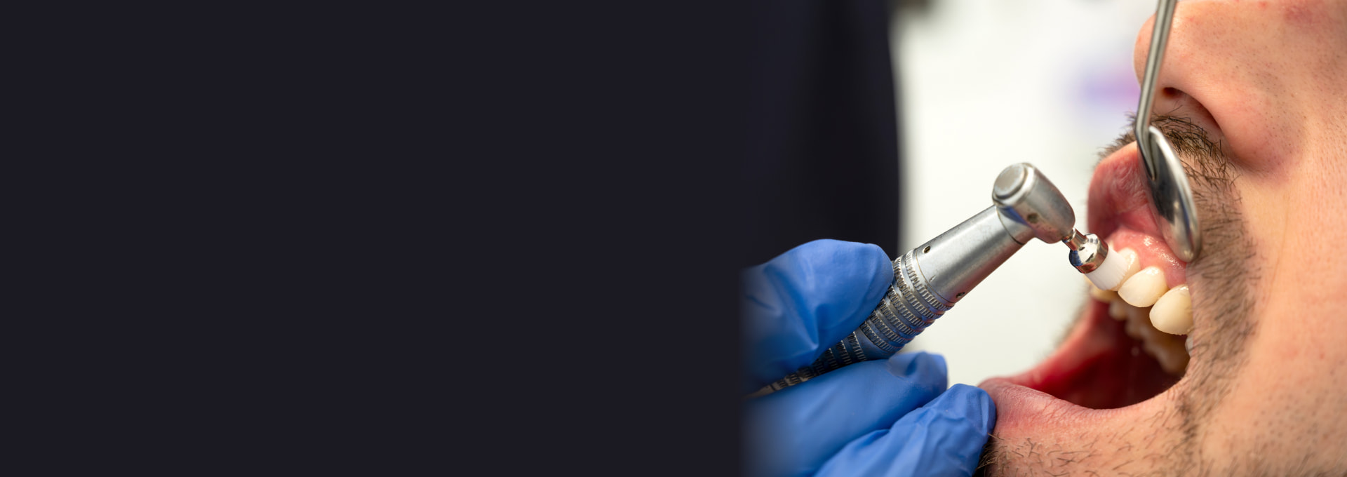 Dental Cleanings & Checkups Banner Image