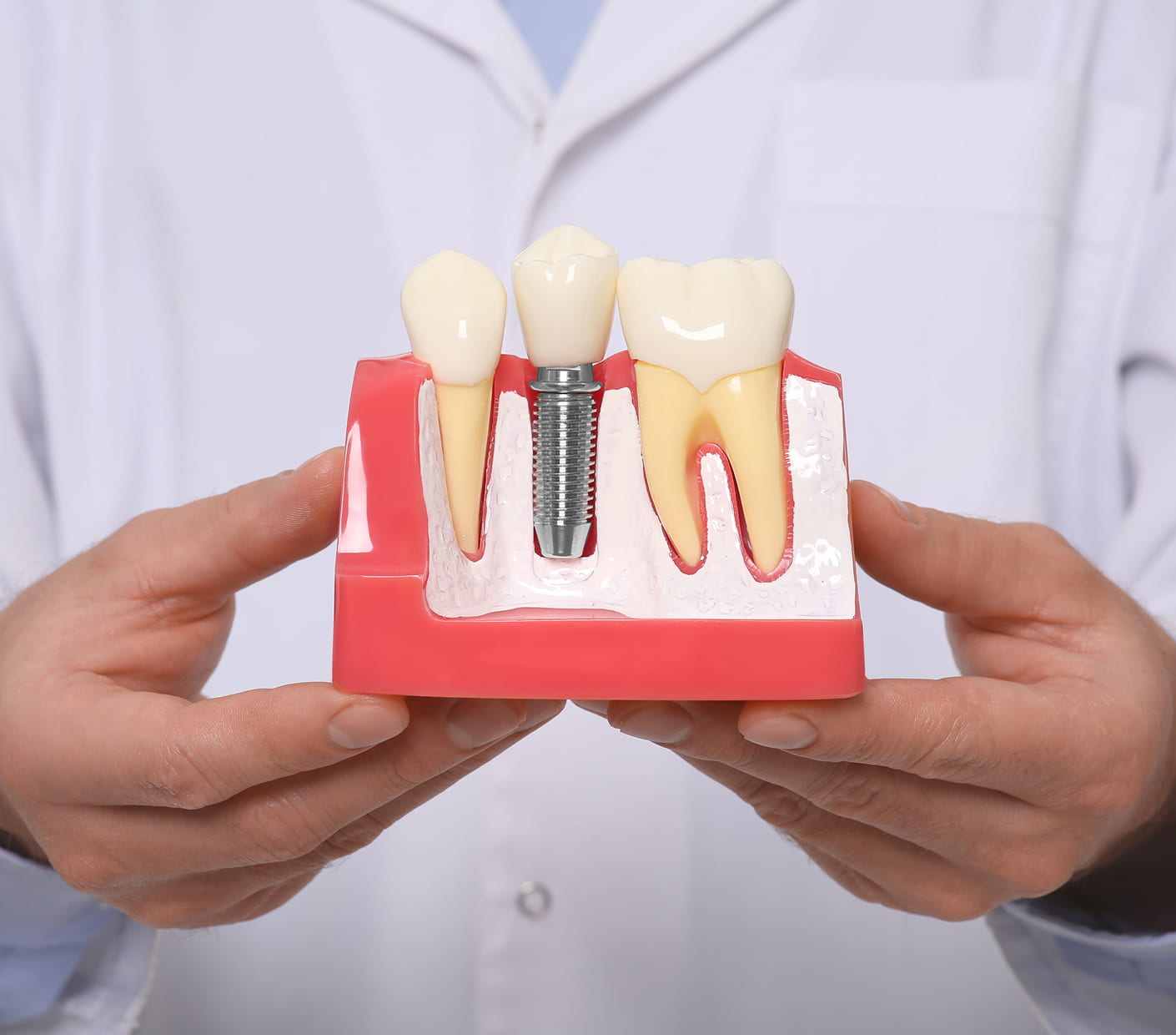 Teeth-In-A-Day