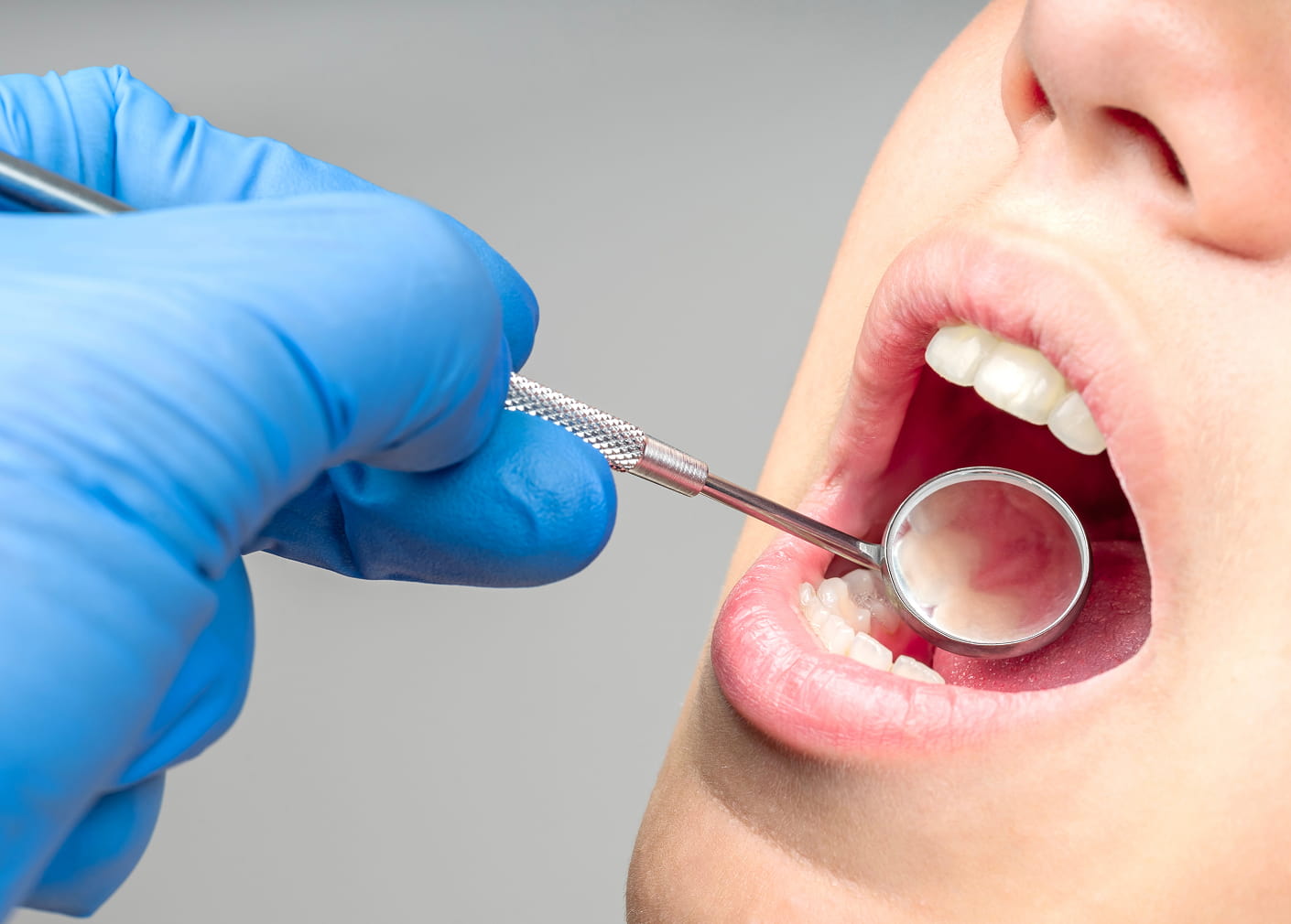 Dental Cleanings & Checkups