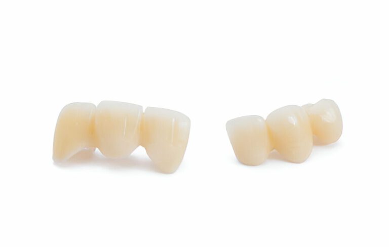 Maximizing the Lifespan of Your Dental Crown: Expert Tips from Gentle Dentistry of Las Colinas in Irving, TX_FI